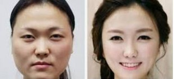 Impact of Plastic Surgery That Celebrity Did and its Effect on Beauty Standards